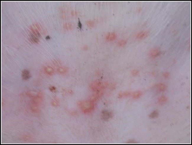 Dog Skin Rash On Belly Pictures